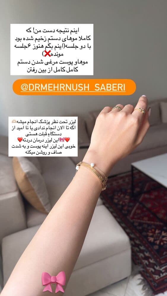  جدید ترین استوری اینستاگرام فرناز