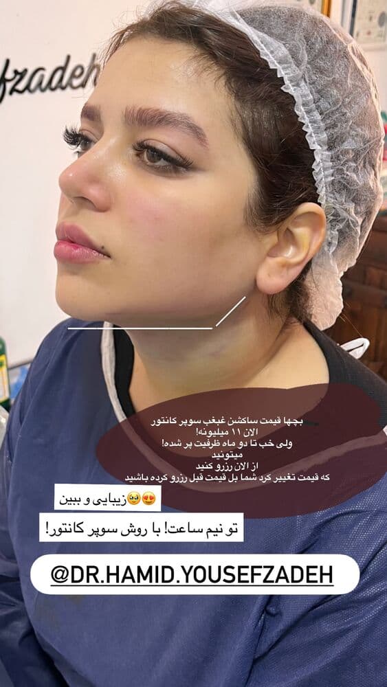 جدید ترین استوری اینستاگرام فرناز