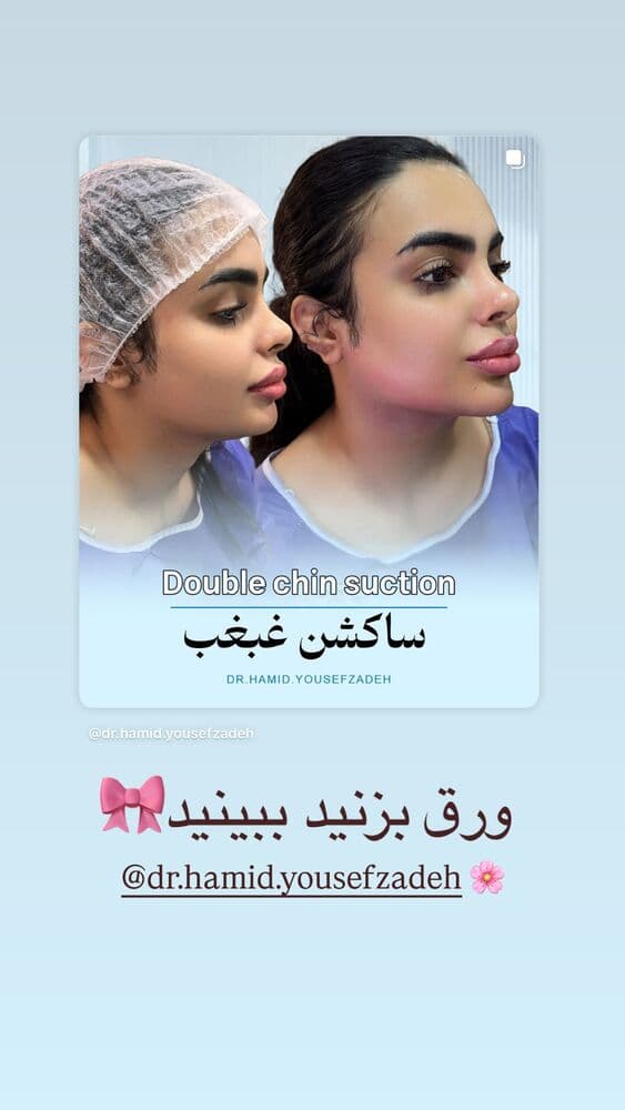  جدید ترین استوری اینستاگرام فرناز