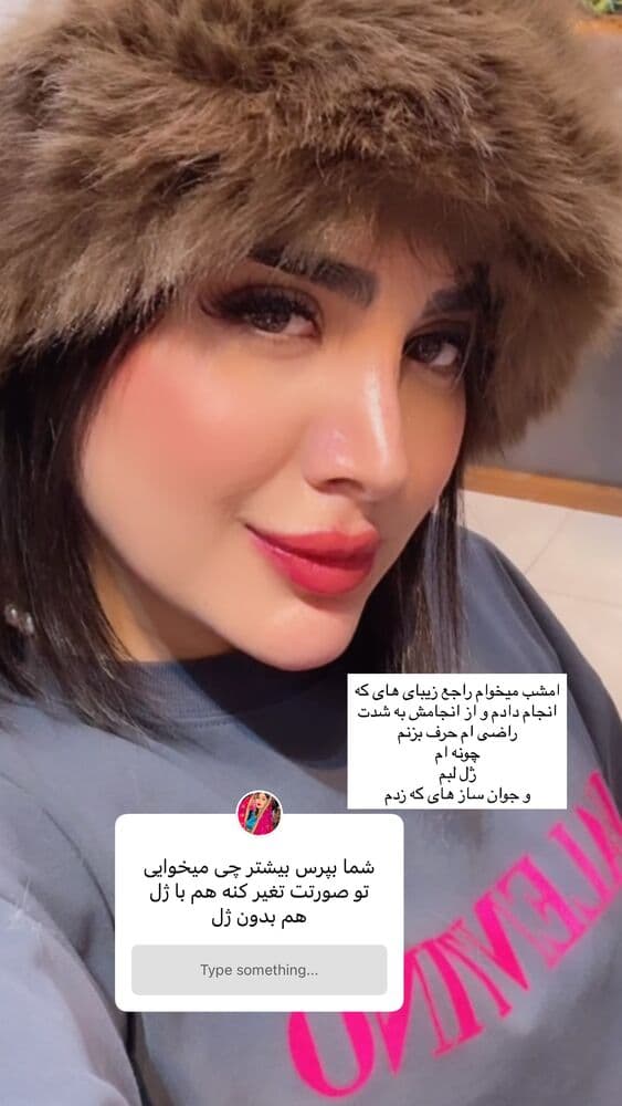  جدید ترین استوری اینستاگرام فرناز