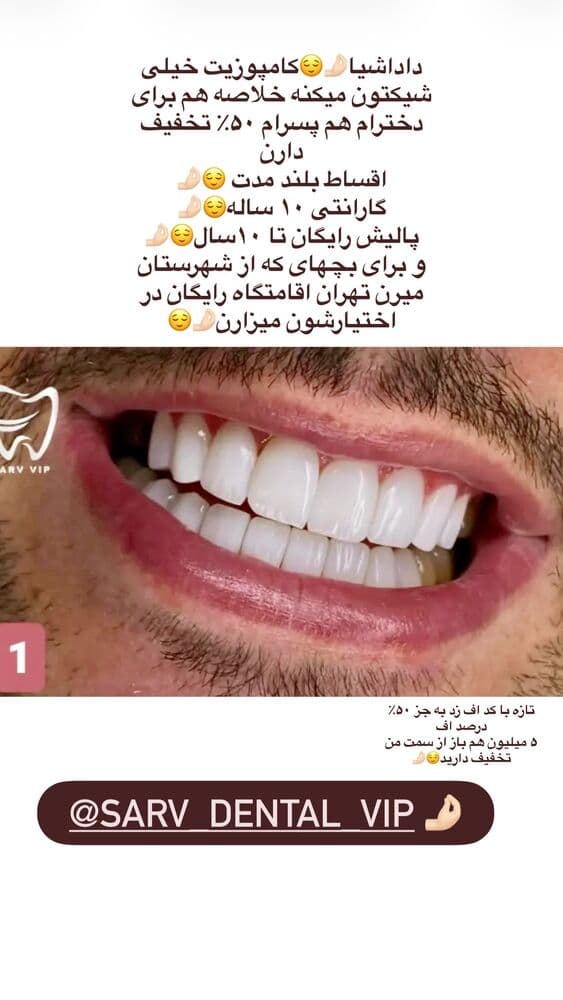  جدید ترین استوری اینستاگرام فرناز