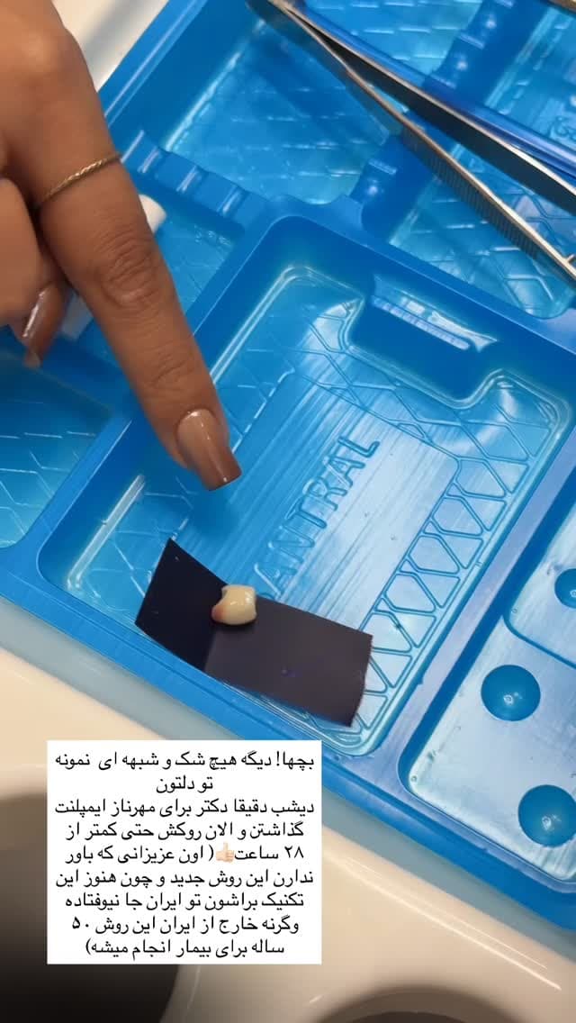  جدید ترین استوری اینستاگرام فرناز
