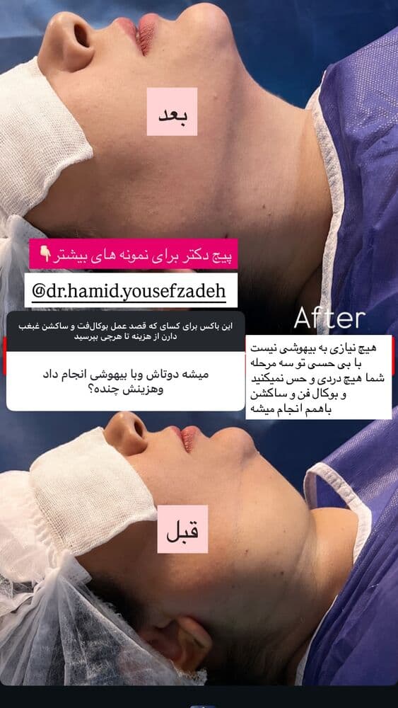  جدید ترین استوری اینستاگرام فرناز