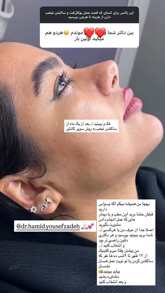  جدید ترین استوری اینستاگرام فرناز