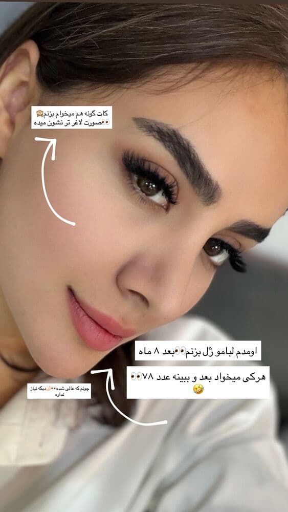  جدید ترین استوری اینستاگرام فرناز