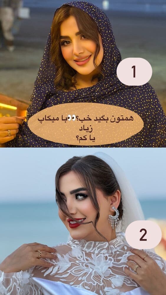  جدید ترین استوری اینستاگرام فرناز