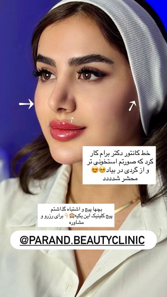  جدید ترین استوری اینستاگرام فرناز