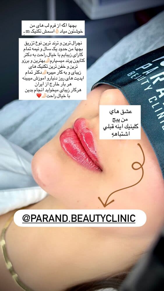  جدید ترین استوری اینستاگرام فرناز