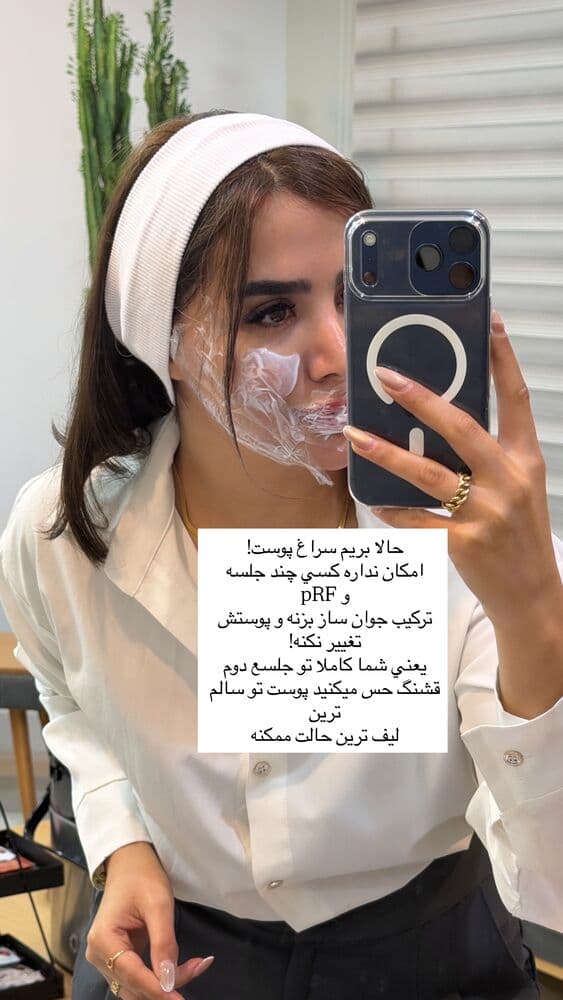  جدید ترین استوری اینستاگرام فرناز