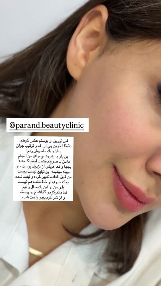  جدید ترین استوری اینستاگرام فرناز