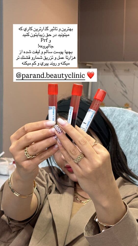  جدید ترین استوری اینستاگرام فرناز