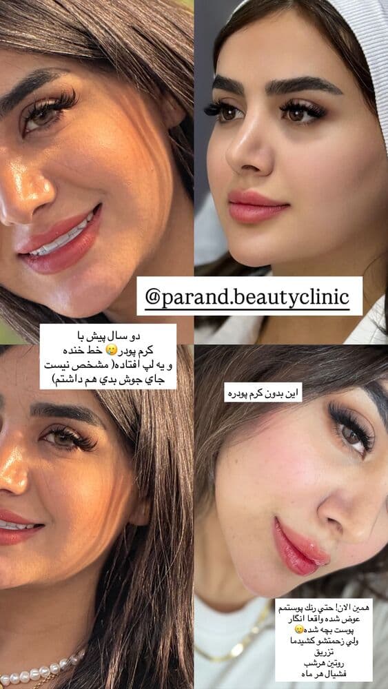  جدید ترین استوری اینستاگرام فرناز