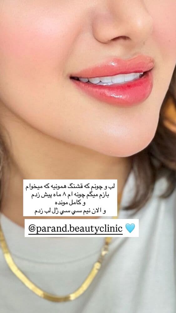  جدید ترین استوری اینستاگرام فرناز