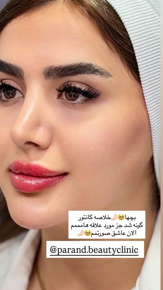  جدید ترین استوری اینستاگرام فرناز