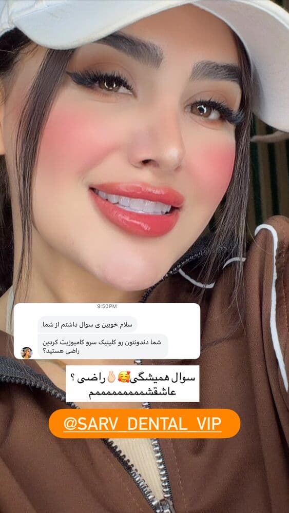  جدید ترین استوری اینستاگرام فرناز
