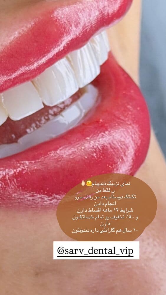  جدید ترین استوری اینستاگرام فرناز