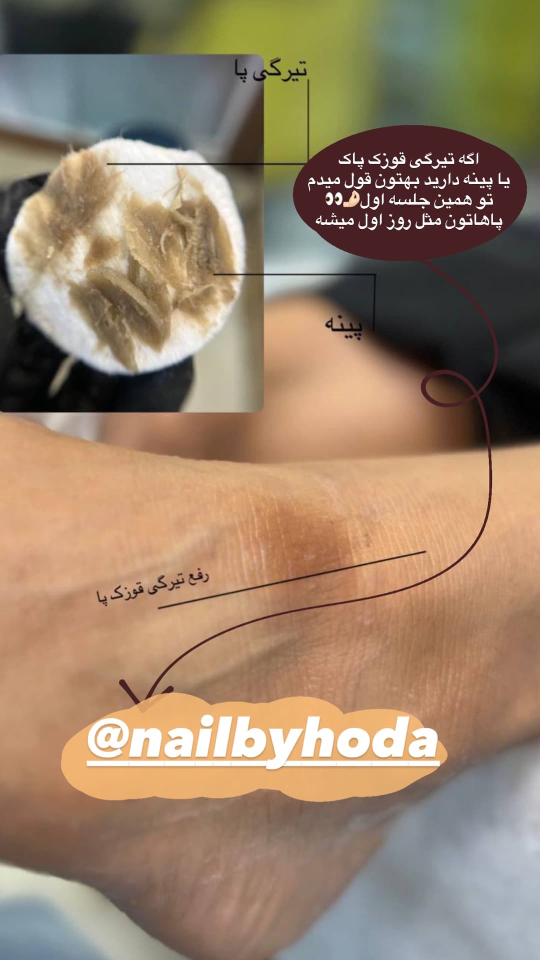  جدید ترین استوری اینستاگرام فرناز