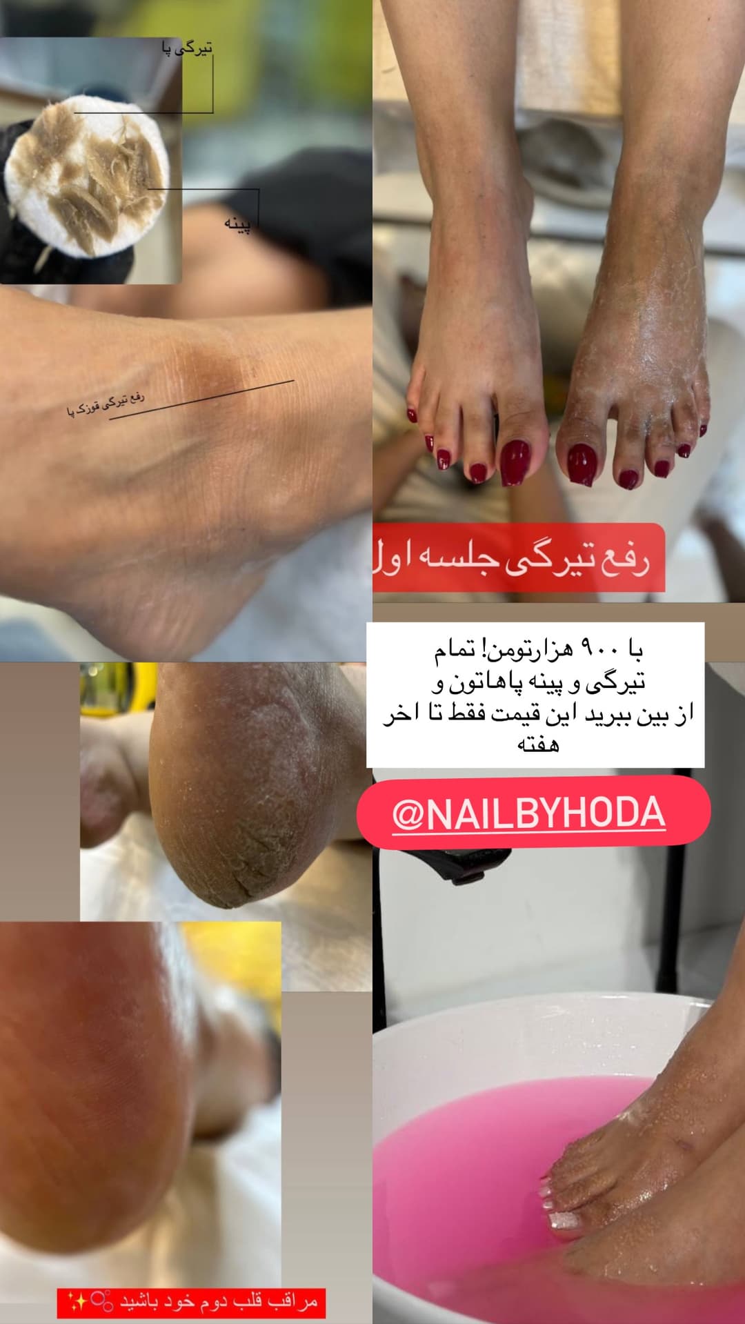  جدید ترین استوری اینستاگرام فرناز