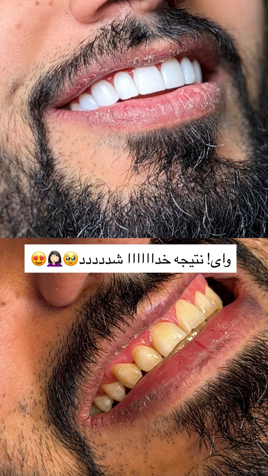  جدید ترین استوری اینستاگرام فرناز