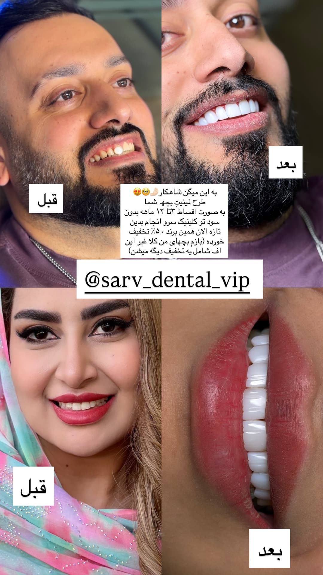  جدید ترین استوری اینستاگرام فرناز