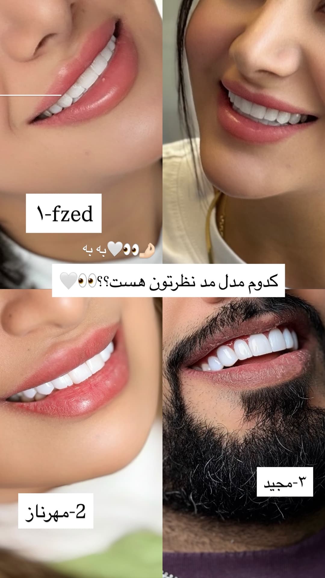  جدید ترین استوری اینستاگرام فرناز