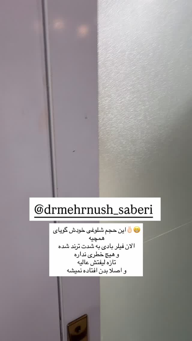  جدید ترین استوری اینستاگرام فرناز