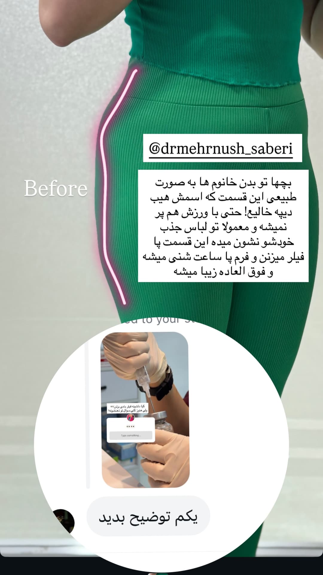  جدید ترین استوری اینستاگرام فرناز