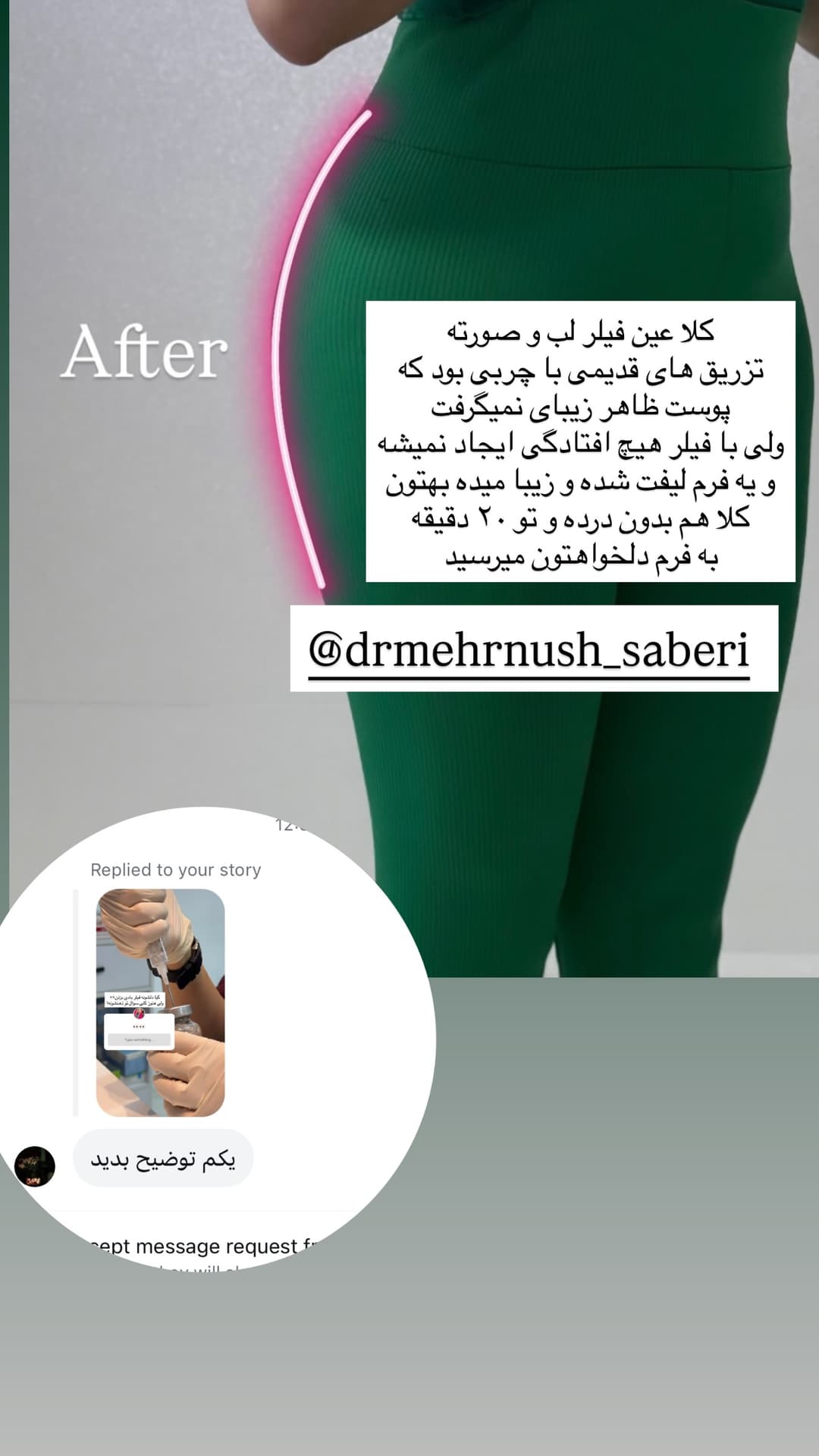  جدید ترین استوری اینستاگرام فرناز