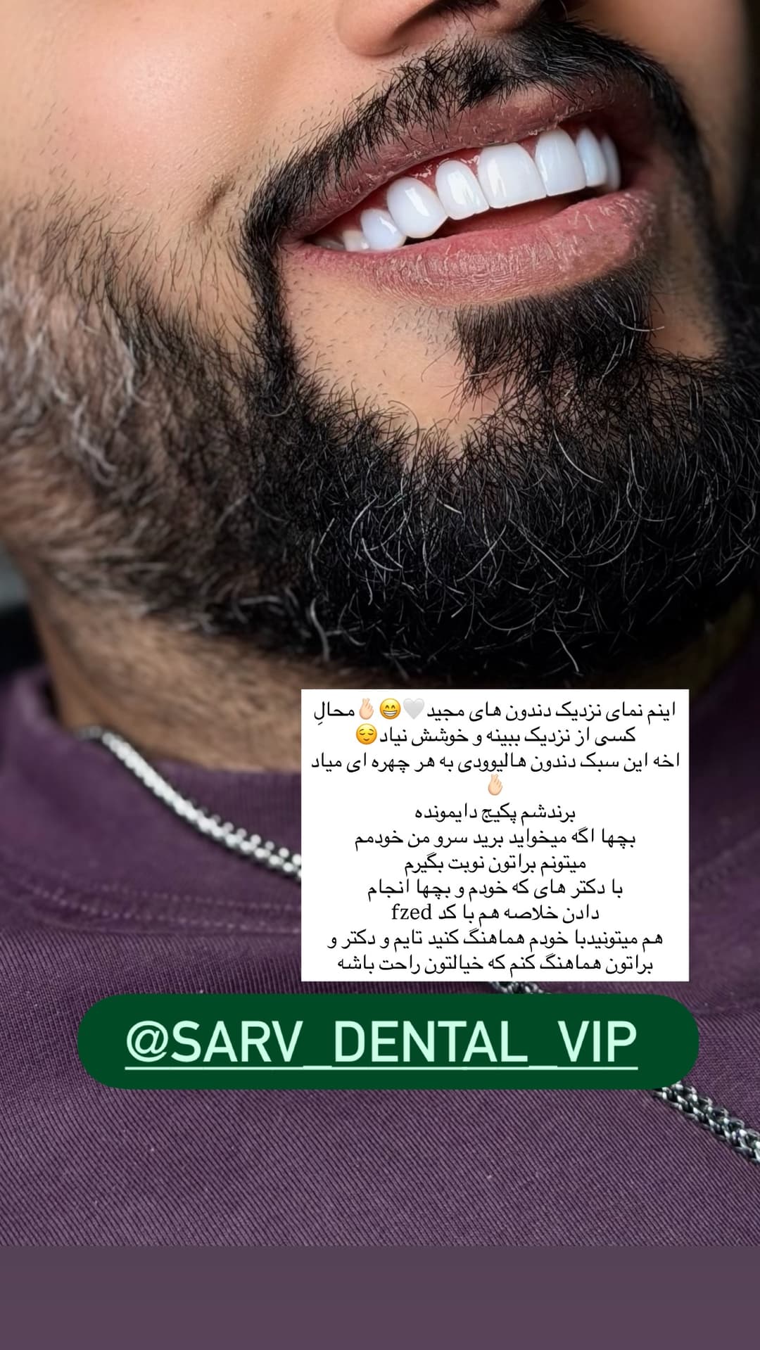  جدید ترین استوری اینستاگرام فرناز