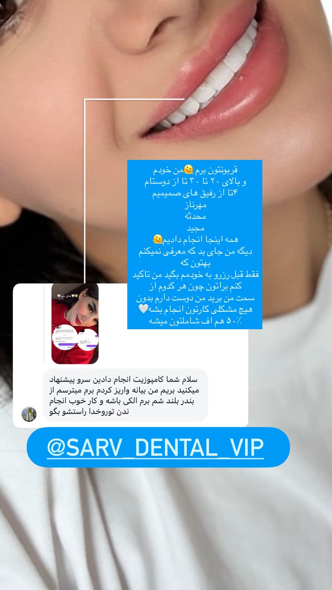  جدید ترین استوری اینستاگرام فرناز