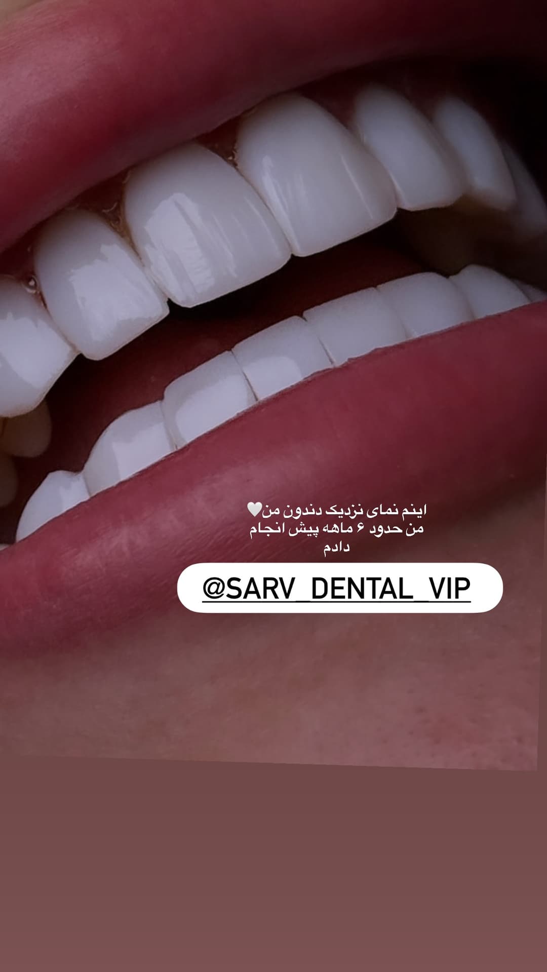  جدید ترین استوری اینستاگرام فرناز