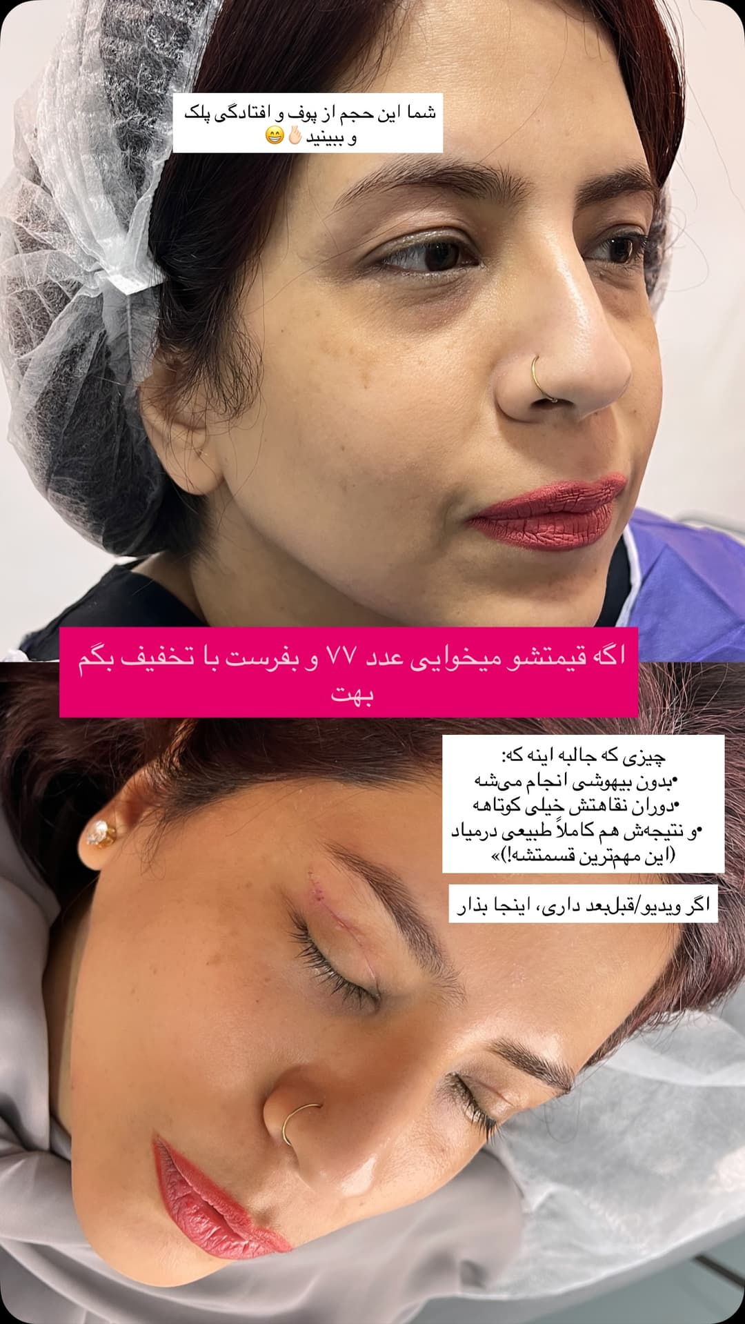  جدید ترین استوری اینستاگرام فرناز