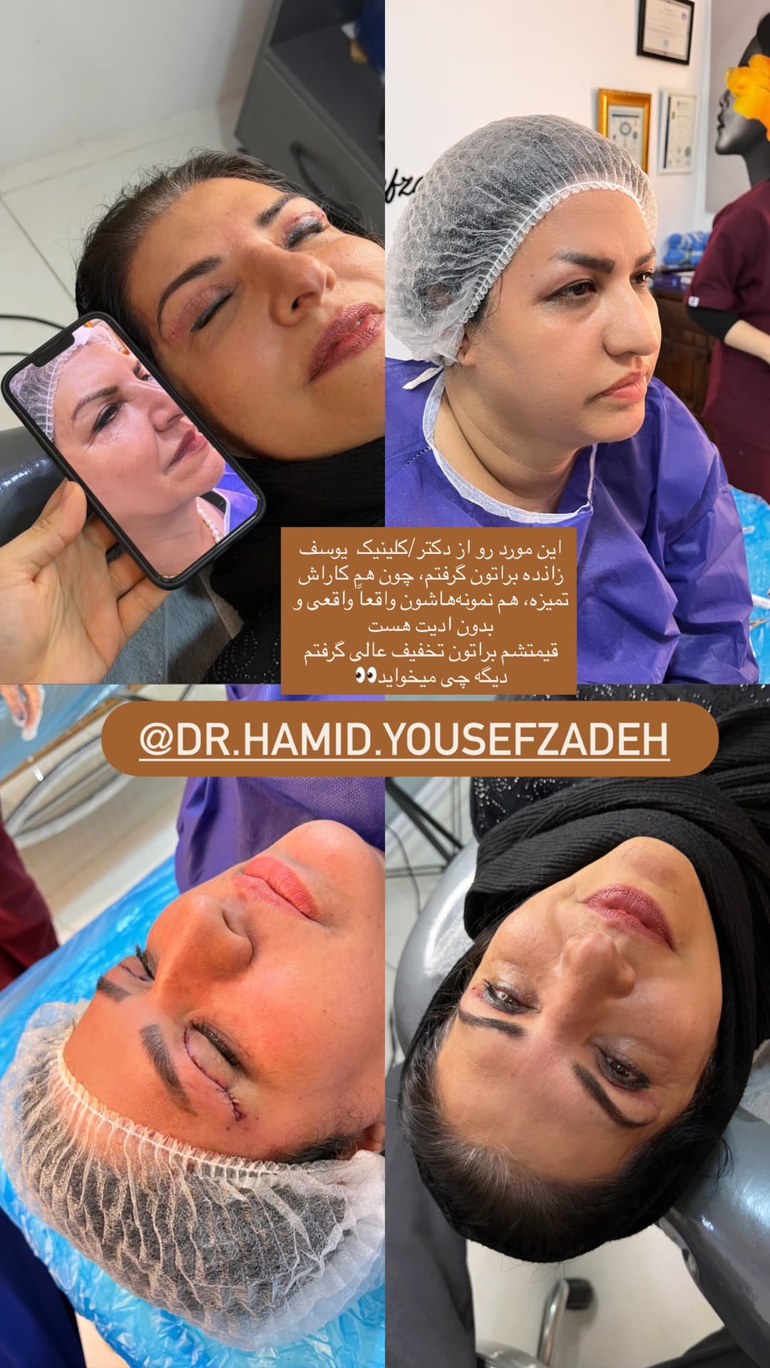 جدید ترین استوری اینستاگرام فرناز