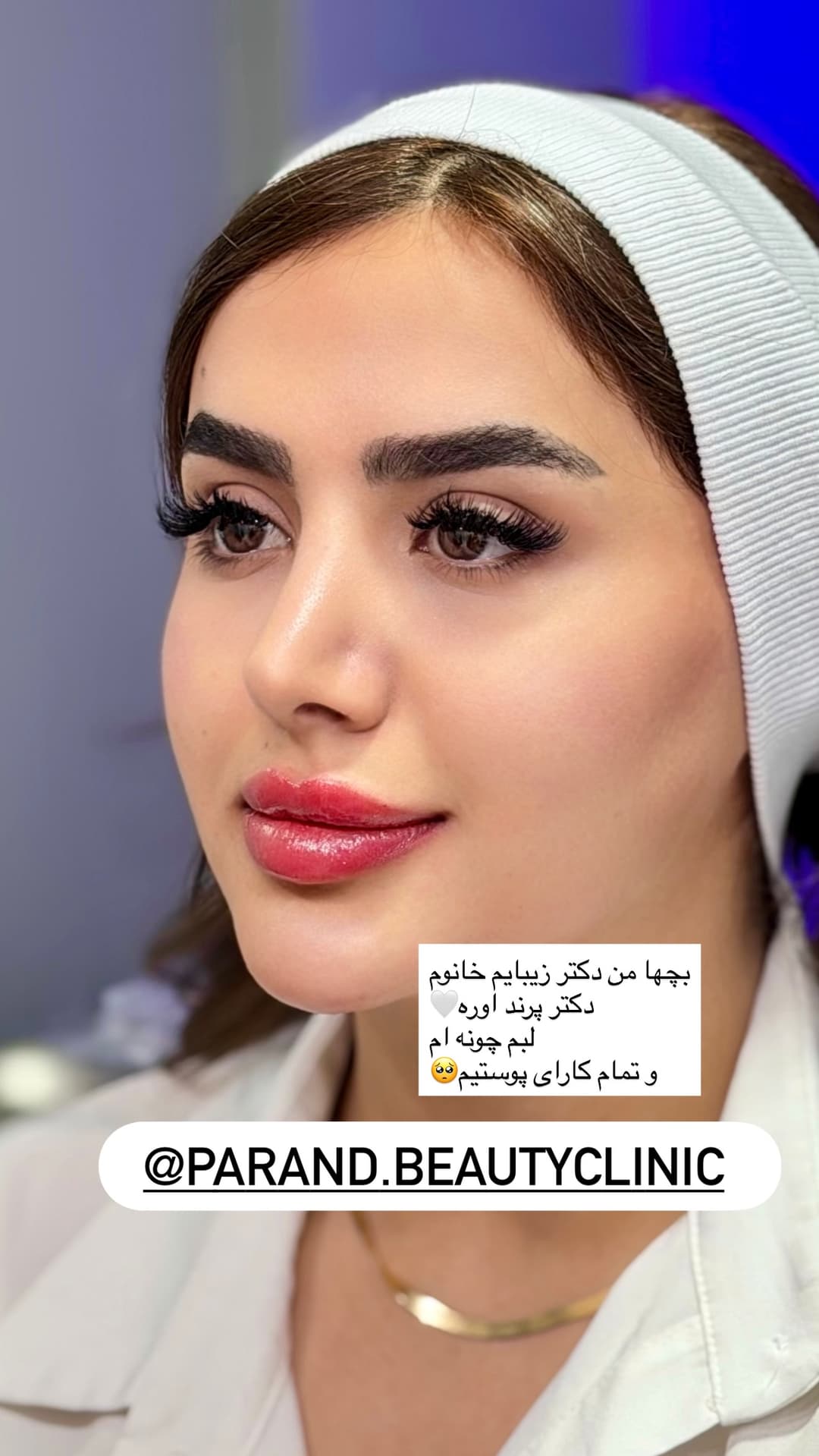  جدید ترین استوری اینستاگرام فرناز