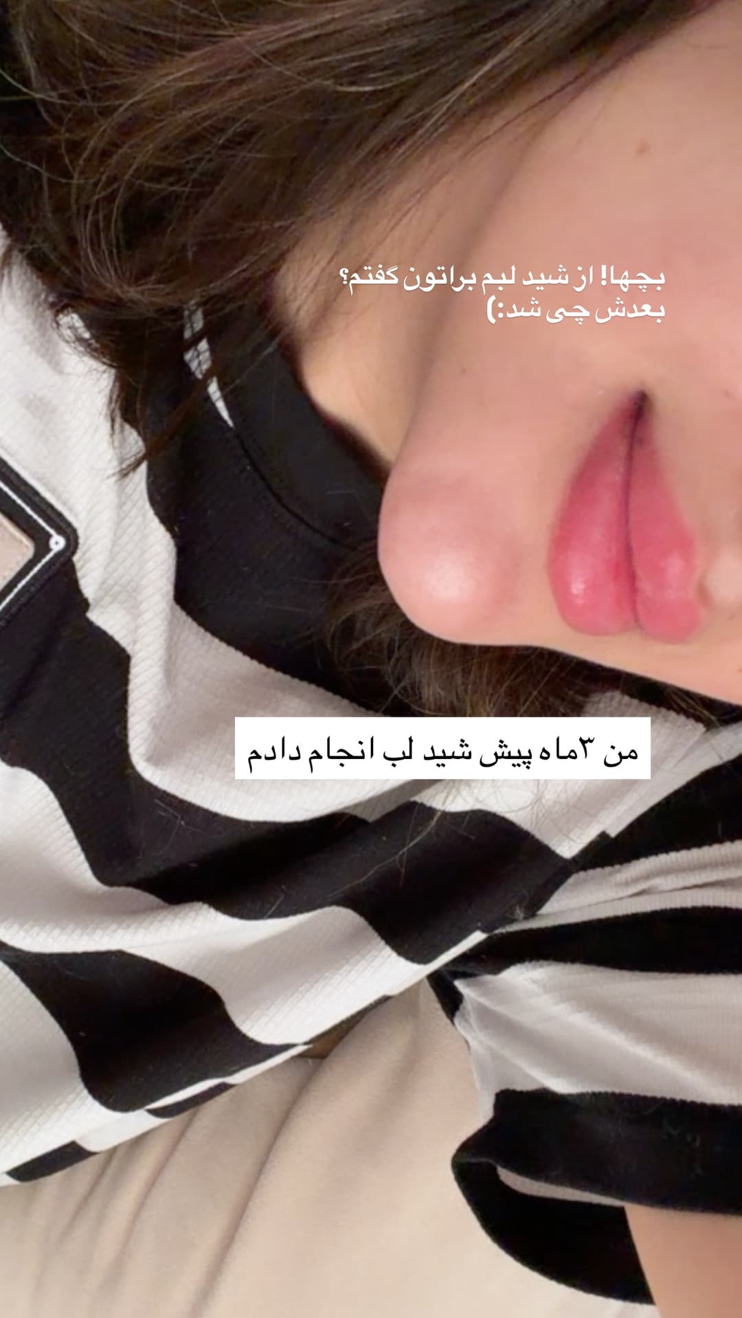  جدید ترین استوری اینستاگرام فرناز