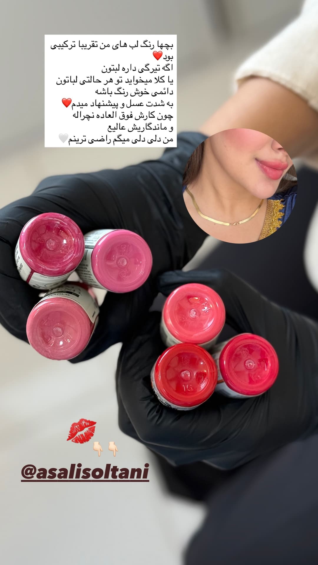  جدید ترین استوری اینستاگرام فرناز