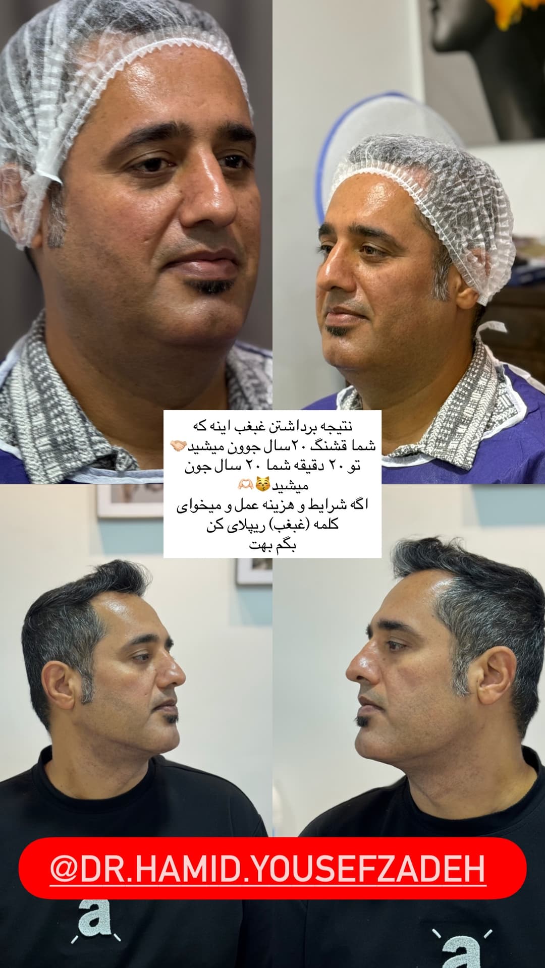  جدید ترین استوری اینستاگرام فرناز