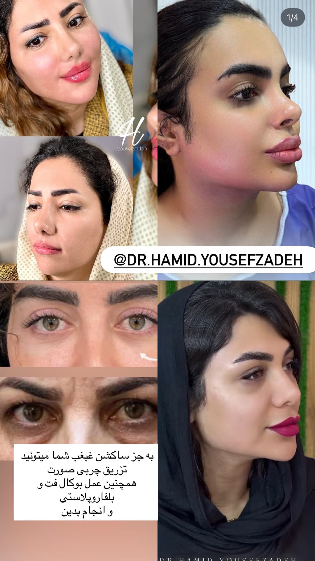  جدید ترین استوری اینستاگرام فرناز