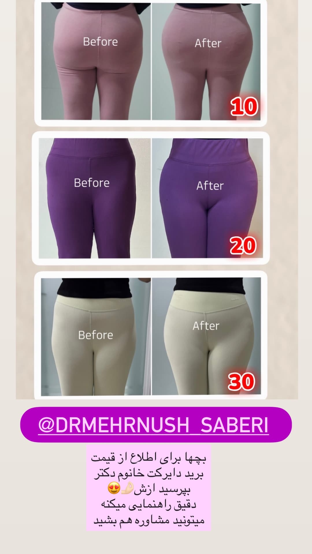  جدید ترین استوری اینستاگرام فرناز