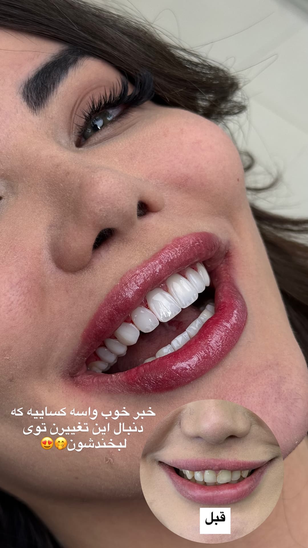  جدید ترین استوری اینستاگرام شیما