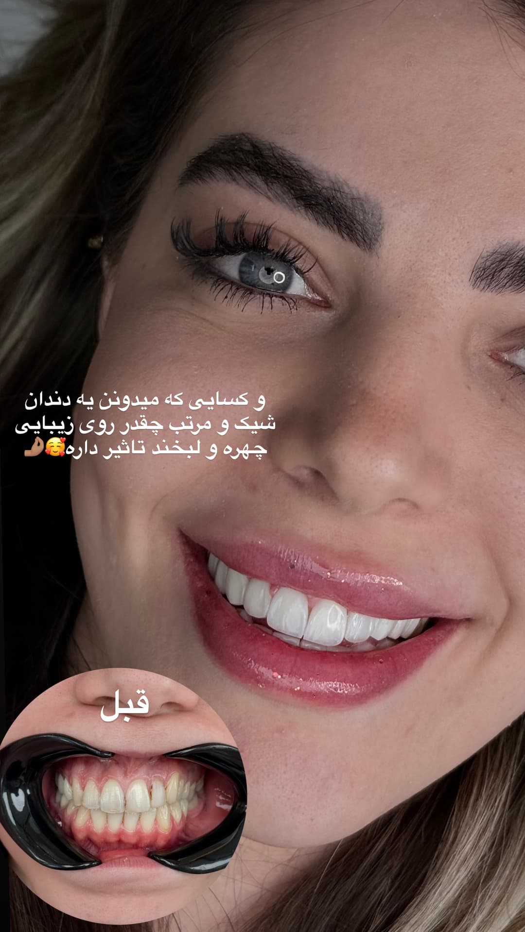  جدید ترین استوری اینستاگرام شیما