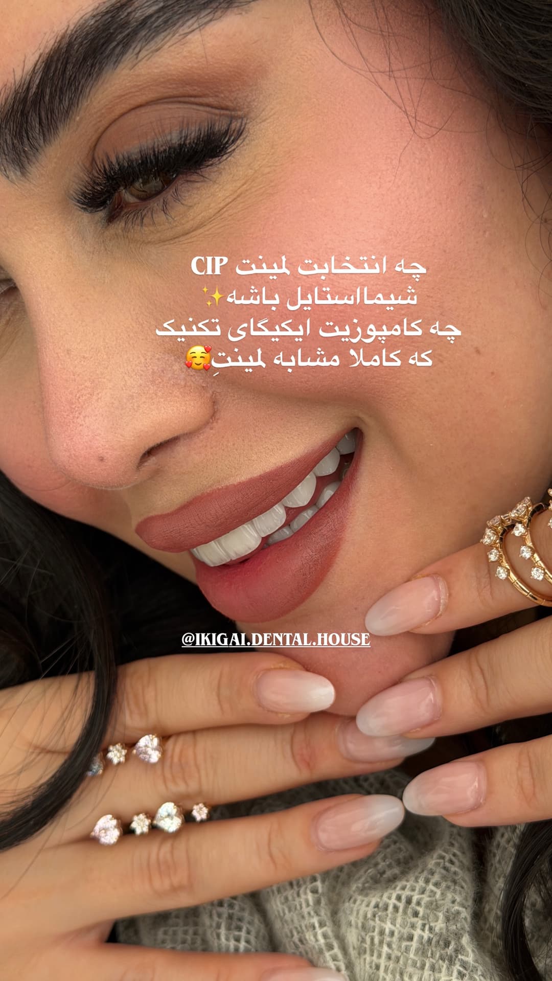  جدید ترین استوری اینستاگرام شیما