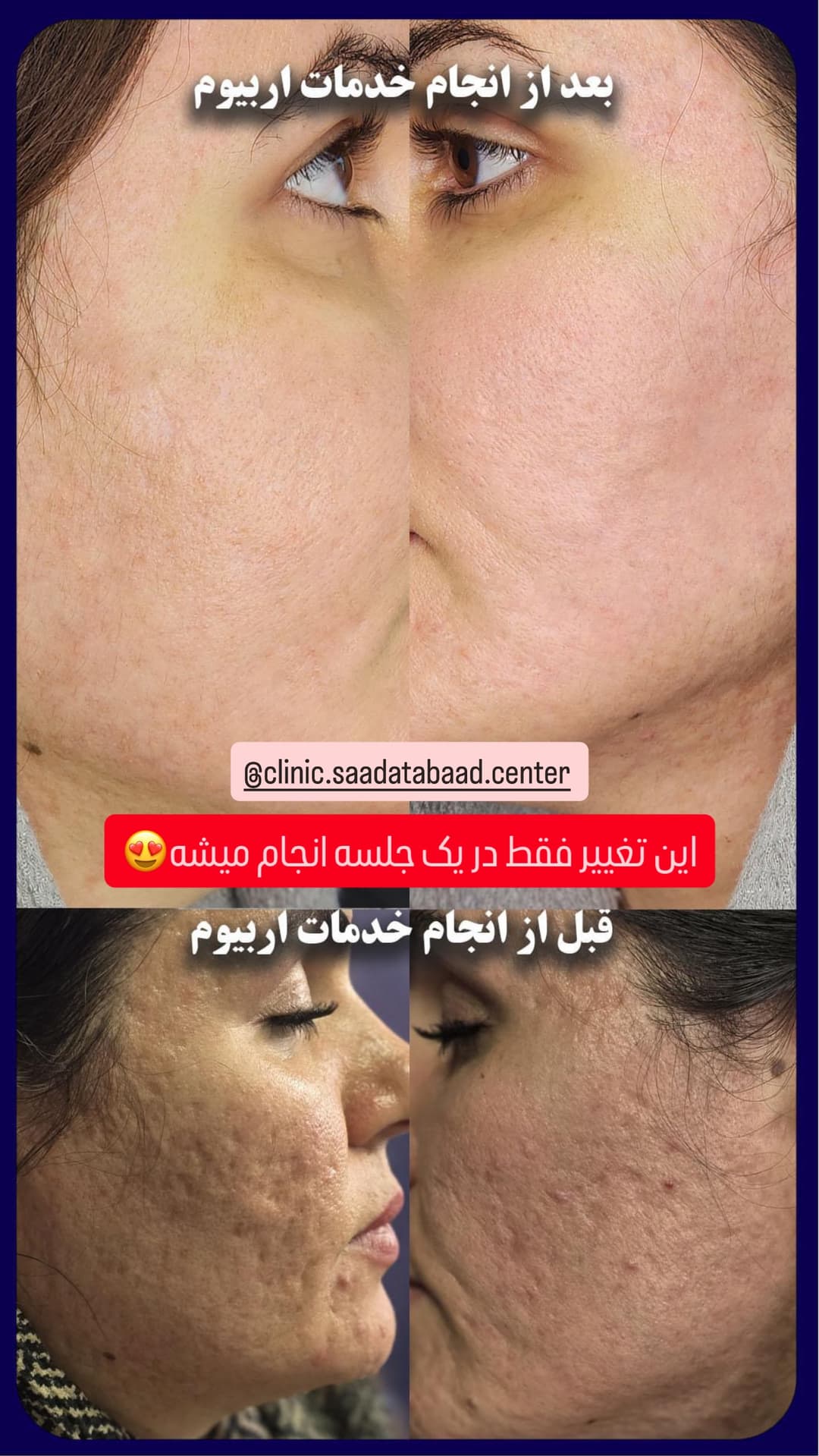  جدید ترین استوری اینستاگرام شیما