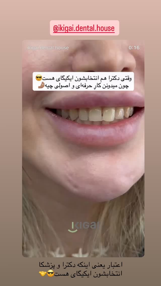  جدید ترین استوری اینستاگرام شیما