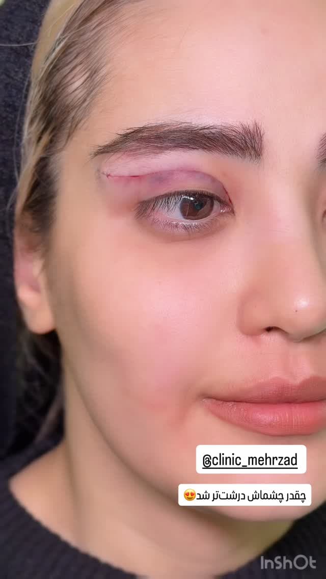  جدید ترین استوری اینستاگرام شیما