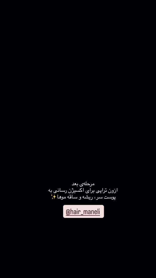  جدید ترین استوری اینستاگرام شیما