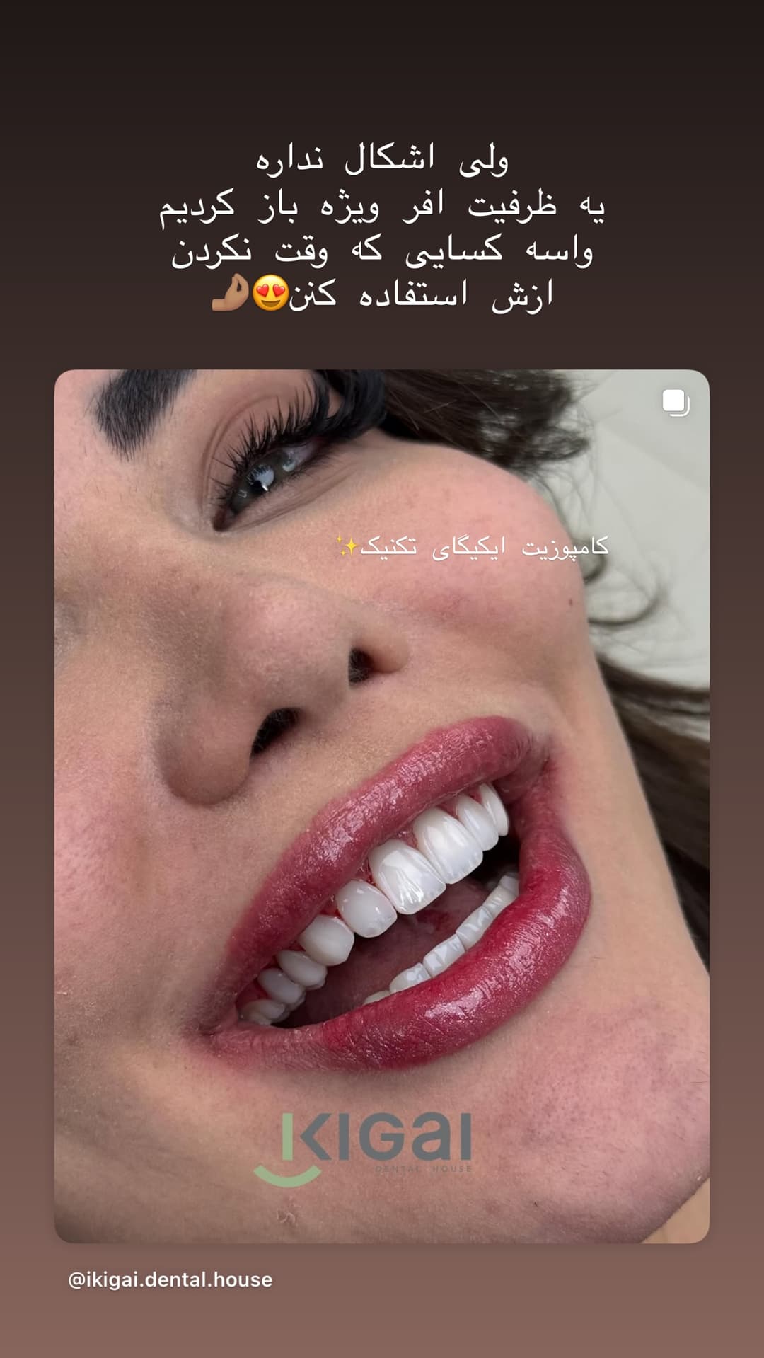  جدید ترین استوری اینستاگرام شیما
