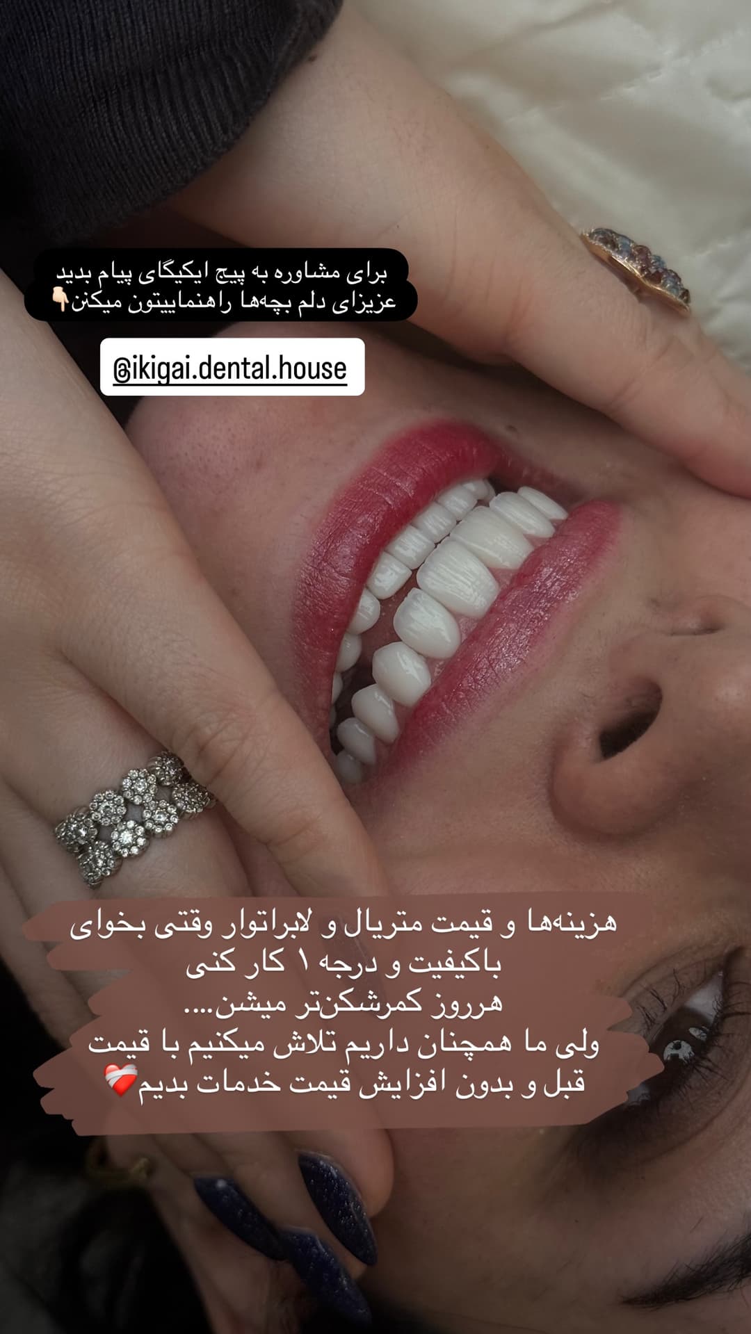  جدید ترین استوری اینستاگرام شیما