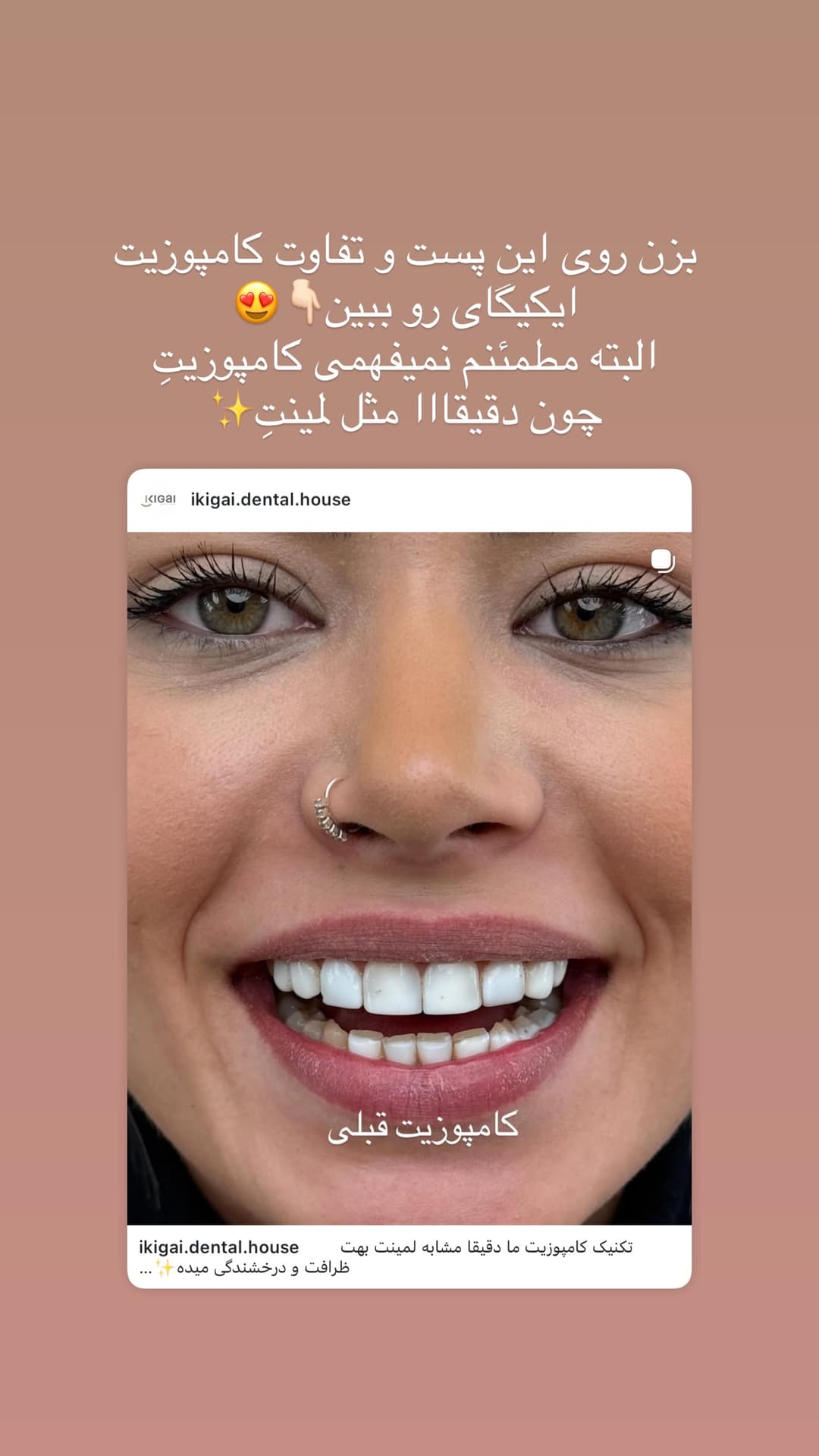  جدید ترین استوری اینستاگرام شیما