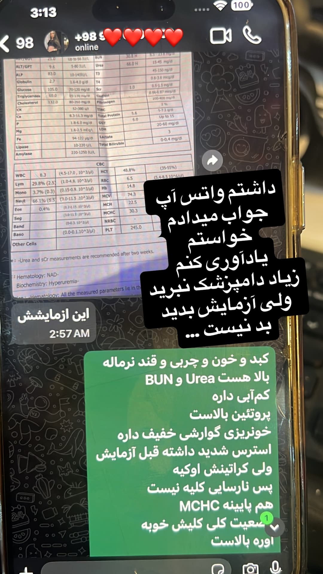  جدید ترین استوری اینستاگرام مسعود رضوی